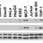 <strong>Figure 2 Independent Antibody Validation (IAV) via Protein Expression Profile in Cell Lines</strong><br>Loading: 15 μg of lysates per lane.Antibodies: ASC 2287, (2 μg/mL), ASC 39-001, (2 μg/mL), beta-actin (1 μg/mL) and GAPDH (0.02 μg/mL), 1h incubation at RT in 5% NFDM/TBST.Secondary: Goat anti-rabbit or goat anti-mouse (for ASC 39001) IgG HRP conjugate at 1:10000 dilution.