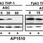 <strong>Figure 7 KD Validation of ASC in THP-1 Cells (Dowds et al., 2004) </strong><br>Immunofluorescence analysis with anti-ASC antibodies (2287) was performed for BIM in 293 cells transfected with GFP siRNA or ASC siRNA. ASC expression was disrupted after ASC siRNA knockdown.