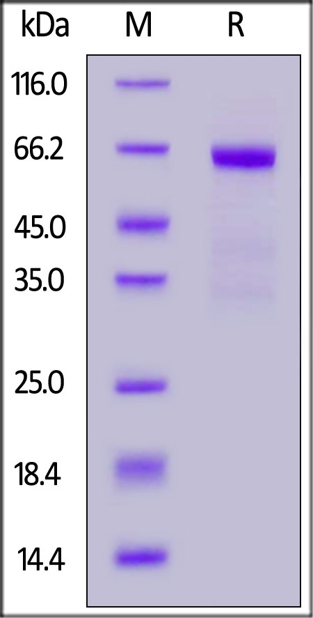ASGR1 / ASGPR1 Recombinant Protein
