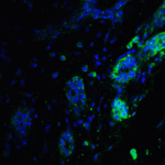 Immunofluorescence of ATF6 in human breast tissue with ATF6 antibody at 20 μg/ml.<br><br>Green: ATF6 Antibody (3681) <br> Blue: DAPI staining