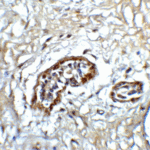 Immunohistochemistry of ATF6 in human breast tissue with ATF6 antibody at 5 μg/ml.