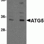 <strong>Figure 1 Western Blot Validation of ATG5 in Mouse Spleen </strong><br>Loading: 15 μg of lysates per lane.Antibodies: ATG5, 1h incubation at RT in 5% NFDM/TBST.Secondary: Goat anti-chicken IgG HRP conjugate at 1:10000 dilution.Lane A: 1 μg/mLLane B: 2 μg/mL