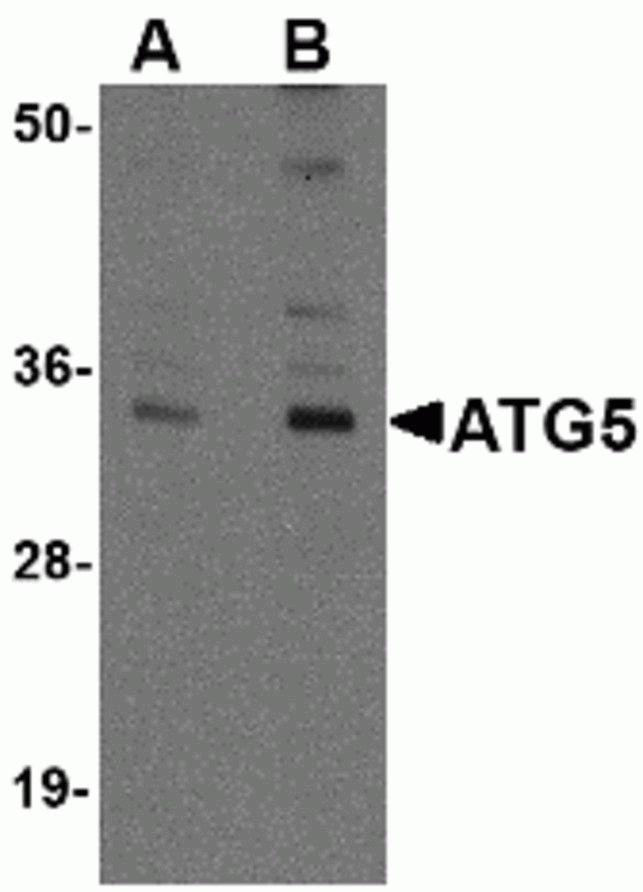 ATG5 Antibody