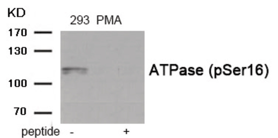 ATPase (phospho Ser16) Antibody