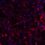 Immunofluorescence of AXIN2 in mouse lung tissue with AXIN2 antibody at 20 μg/mL.<br><br>Red: AXIN2 Antibody (6163) <br> Blue: DAPI staining