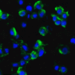 Immunofluorescence of AXIN2 in HepG2 cells with AXIN2 Antibody at 20 μg/ml.