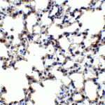 Immunohistochemistry of AXIN2 in mouse lung tissue with AXIN2 antibody at 5 μg/mL.