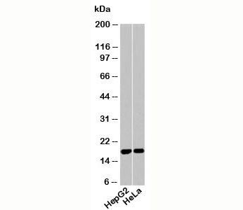 Acid Phosphatase (Isoform 2 specific) Antibody