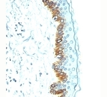 Acidic Cytokeratin Antibody [AE1]