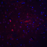 Immunofluorescence of Adiponectin in mouse brain tissue with Adiponectin antibody at 20 μg/mL.<br><br>Red: Adiponectin Antibody (3551) <br> Blue: DAPI staining
