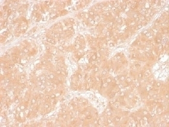 Adipophilin Antibody [ADFP/1366]
