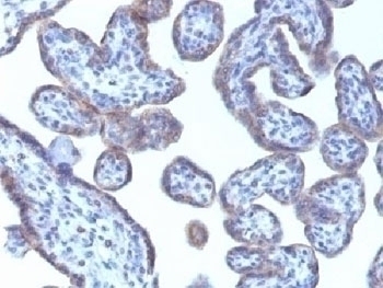 Adipophilin Antibody [ADFP/1493]