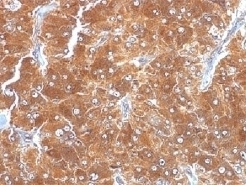 Adipophilin Antibody [ADFP/1494]