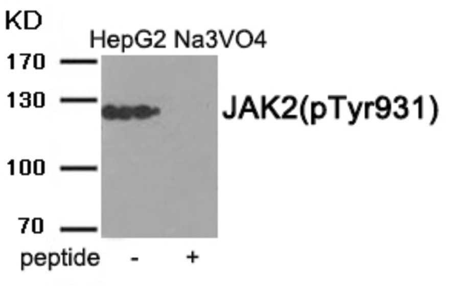 Adrenergic Receptor beta2 (phospho Ser346) Antibody