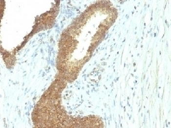 Alkaline Phosphatase Antibody [ALPL/597]