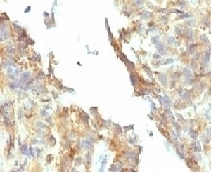 Alkaline Phosphatase Antibody [KSUL-1]