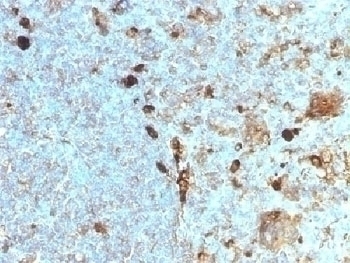 Alpha 1 Antitrypsin Antibody [AAT/1378]
