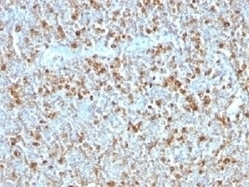 Alpha 1 Antitrypsin Antibody [AAT/1379]