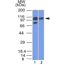 Alpha Catenin Antibody [1G5]