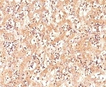 Alpha Fetoprotein Antibody [C3]