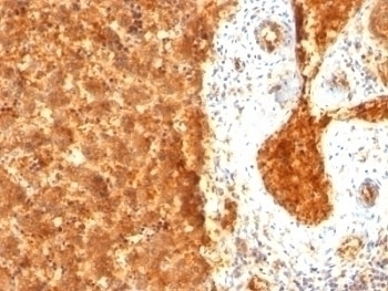 Alpha Fetoprotein Antibody [SPM334]