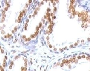 Androgen Receptor Antibody [ANDRC-1]