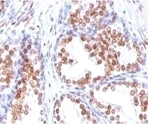Androgen Receptor Antibody [DHTR/882]