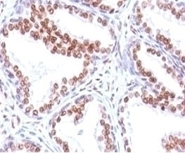 Androgen Receptor Antibody [SPM335]