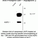 Western blot of vasopressin (AVP) treated rat kidney lysate showing specific immunolabeling of the ~29k and 37k glycosylated form of the AQP2 protein phosphorlyated at Ser269.