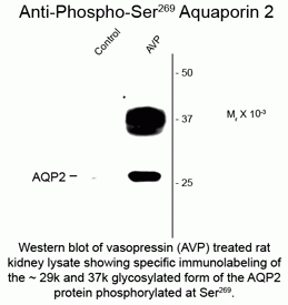 Aquaporin 2 (phospho Ser 269) Antibody