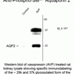 Western blot of vasopressin (AVP) treated rat kidney lysate showing specific immunolabeling of the ~29k and 37k glycosylated form of the AQP2 protein phosphorylated at Ser264.