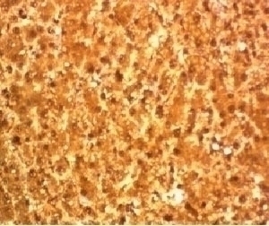 Arginase 1 Antibody [T1ARG-1]