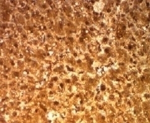 Arginase Antibody [ARG1/1126]