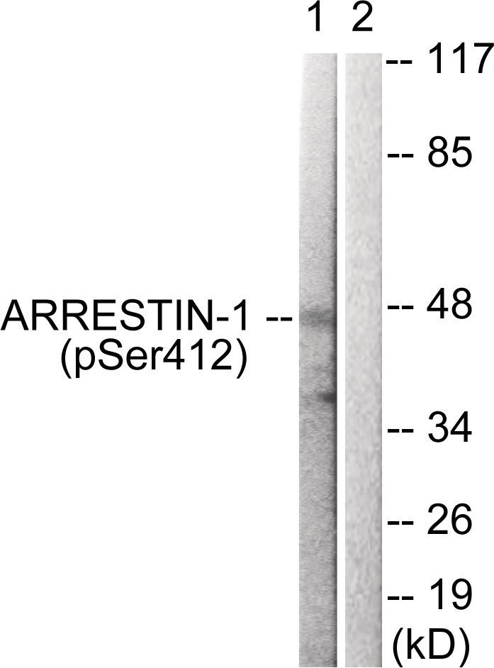 Arrestin 1 (phospho Ser412) Antibody
