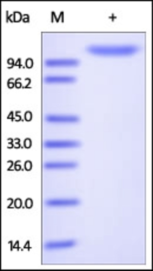 Autotaxin Recombinant Protein