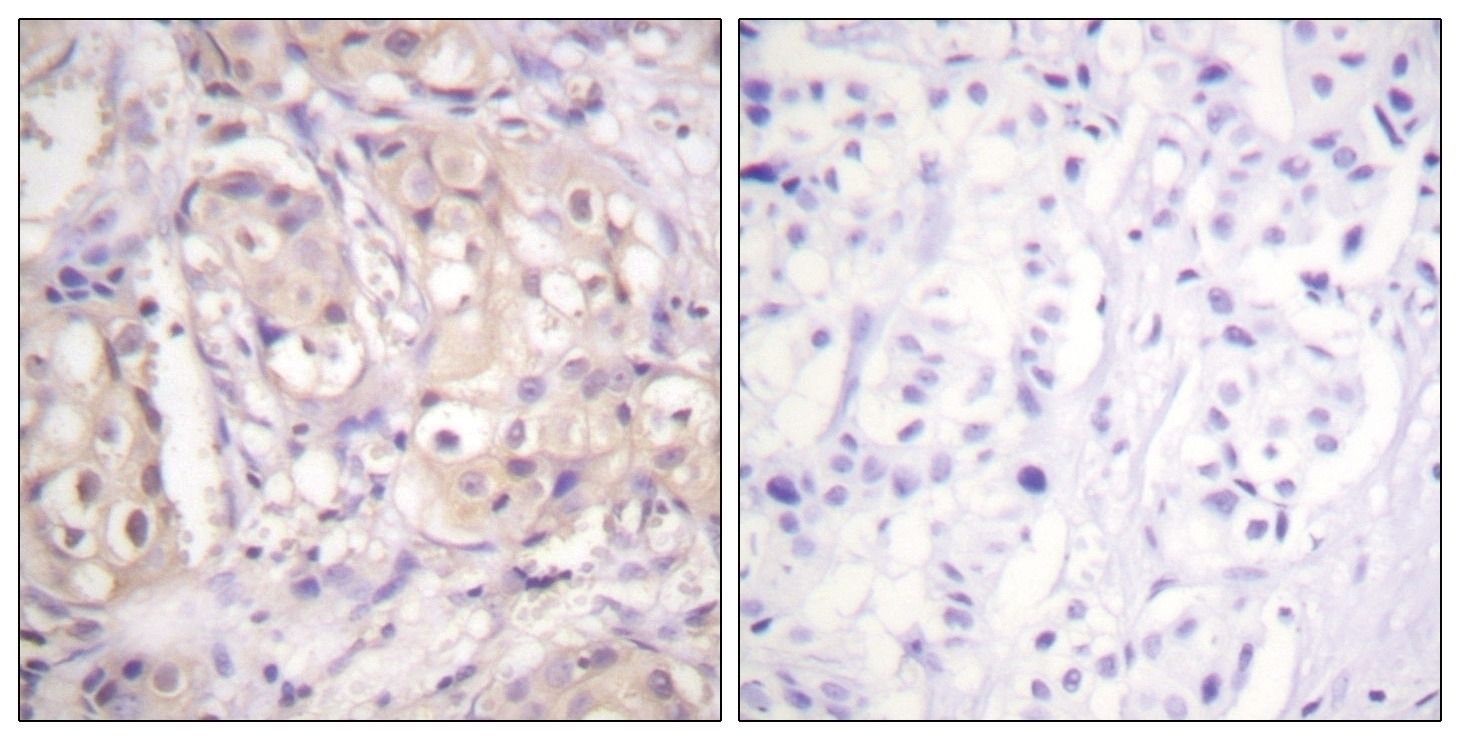 B-RAF (phospho Thr599) Antibody