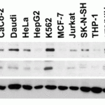 <strong>Figure 2 Independent Antibody Validation (IAV) via Protein Expression Profile in Cell Lines</strong><br>Loading: 15 μg of lysates per lane.Antibodies: B-raf 5777, (0.5 μg/mL), B-raf 7379, (0.5 μg/mL) and GAPDH (0.02 μg/mL), 1h incubation at RT in 5% NFDM/TBST.Secondary: Goat anti-chicken (for 5777) and goat anti-rabbit (for 7379) IgG HRP conjugate at 1:10000 dilution.
