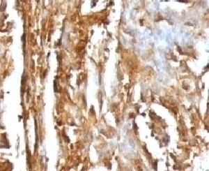 B2M Antibody [MGBP2-1]