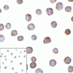 Immunocytochemistry of B7-H3 in HEK293 cells using B7-H3 antibody and control mouse IgG antibody (left corner box) at 1 μg/ml.