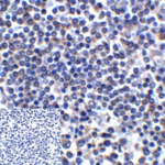 Immunohistochemistry of B7-H3 in human colon carcinoma tissue using B7-H3 Antibody and control mouse IgG (corner box) at 2 μg/ml.