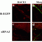 <strong>Figure 10 KD Validation of BACE in DRG (Hyun, 2007) </strong><br> Decreased BACE1 expression in DRG following siRNA3 transfection. DRG neurons were transfected with 1 μg siRNA3 plasmid and incubated for 48 hours in 37°°C. DRG neurons were stained for BACE1 us¬ing the Anti-BACE antibody (ProSci). (a,b) Neurons transfected with the control plas¬mid pSUPER-EGFP (green) did not display any changes in BACE1 expression (red). (c,d) DRG neurons transfected with siR¬NA3 displayed reduced BACE1 expression in the axon.