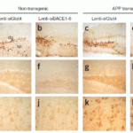 <strong>Figure 7 KD Validation of BACE in Mouse Brain (Singer et al., 2005)</strong><br> Characterization of the effects of lenti-siBACE1-6 expression in the brains of APP transgenic mice. (a–d) Anti-eGFP immunoreactivity in the hippocampus (the injection site) shows comparable and consistent expression of lenti-siRNA constructs in the dentate gyrus (dg) and stratus polymorphus (sp). (e) Anti-BACE1 immunoreactivity in the hippocampus of nontransgenic mice treated with lenti-siGlut4. (f) Reduced BACE1 immunostaining in the hippocampus of nontransgenic mice treated with lenti-siBACE1-6 vector. (g) Intense BACE1 immunoreactivity in the hippocampus of APP transgenic mice treated with lenti-siGlut4. (h) Reduced BACE1 expression in APP transgenic mice treated with lenti-siBACE1-6 vector. (i,j) Anti-BACE1 reacted with pyramidal cell bodies in the neocortex, which was not injected,