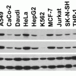 <strong>Figure 2 Independent Antibody Validation (IAV) via Protein Expression Profile in Cell Lines</strong><br>Loading: 15 μg of lysates per lane.Antibodies: BACE 2253 (1 μg/mL), BACE 32-238 (1 μg/mL), beta-actin (1 μg/mL), and GAPDH (0.02 μg/mL), 1h incubation at RT in 5% NFDM/TBST.Secondary: Goat anti-rabbit IgG HRP conjugate at 1:10000 dilution.