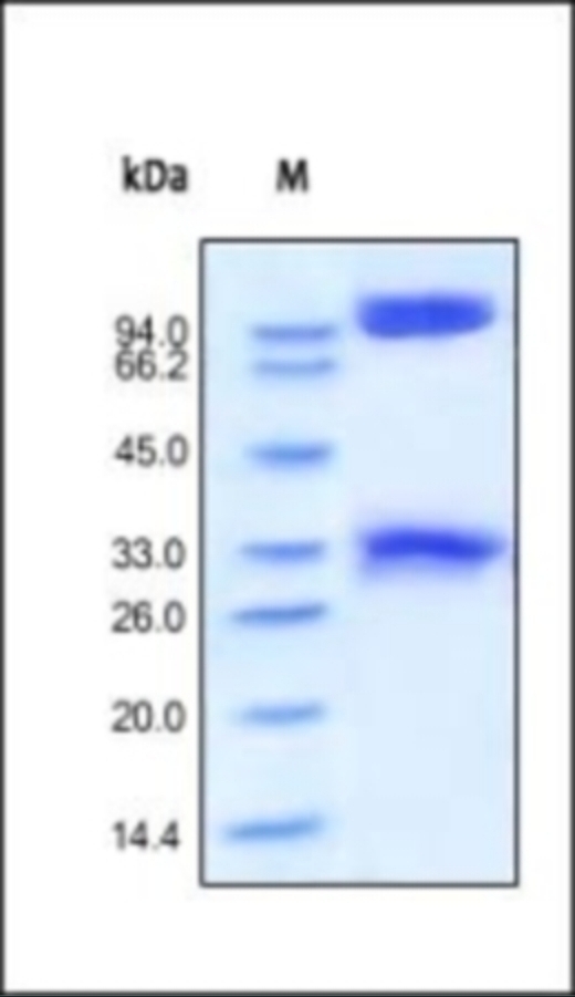 BACE1 Recombinant Protein