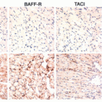 <strong>Figure 8  Immunohistochemistry Validation of BAFF in Murine Cardiac Transplants at Rejection (Ye et al., 2004) </strong><br>BAFF expression detected by anti-BAFF antibodies (2221) was upregulated in intragraft leukocytes due to rejection at 7 days after heart transplant.