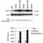 <strong>Figure 6  Regulated Expression Validation of BAFF in Myeloma Patients  (Tai et al., 2006) </strong><br>Immunoblot analysis was performed to monitor protein expression of BAFF with anti-BAFF antibodies in multiple myeloma cells with or without BMSCs. BAFF expression in cocultures at 8hr or 24hr was up-regulated by ~3.5-fold relative to BMSCs alone.
