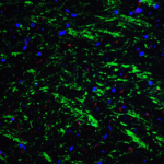 Immunofluorescence of BAG 1 in mouse brain tissue with BAG 1 Antibody at 20 μg/mL. <br><br>Green: BAG 1 antibody (3869) <br> Red: Phylloidin staining<br> Blue: DAPI staining