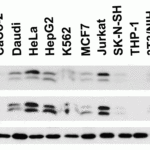 <strong>Figure 1 Independent Antibody Validation (IAV) via Protein Expression Profile in Human Lines</strong><br>Loading: 15 μg of lysates per lane.Antibodies: BANF1, 4017 (2 μg/mL), BANF1, 4019 (2 μg/mL) and beta-actin (1.5 μg/mL),  1h incubation at RT  in 5% NFDM/TBST.Secondary: Goat anti-rabbit IgG HRP conjugate at 1:10000 dilution.