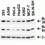 <strong>Figure 2 Independent Antibody Validation (IAV) via Protein Expression Profile in Human Cell Lines</strong><br>Loading: 15 μg of lysates per lane.Antibodies:  BAP31, 3675 (0.5 μg/mL), BAP31, 64-237 (2 μg/mL), and beta-actin 3779 (1.5 μg/mL),  1h incubation at RT  in 5% NFDM/TBST.Secondary: Goat anti-rabbit IgG HRP conjugate at 1:10000 dilution.