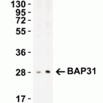 <strong>Figure 3 Western Blot Validation in Rat Lung Tissue Lysate</strong><br>Loading: 15 μg of lysates per lane.Antibodies: BAP31, 3665 (Lane 1: 1 μg/mL and Lane 2: 2 μg/mL), 1h incubation at RT in 5% NFDM/TBST.Secondary: Goat anti-rabbit IgG HRP conjugate at 1:10000 dilution.